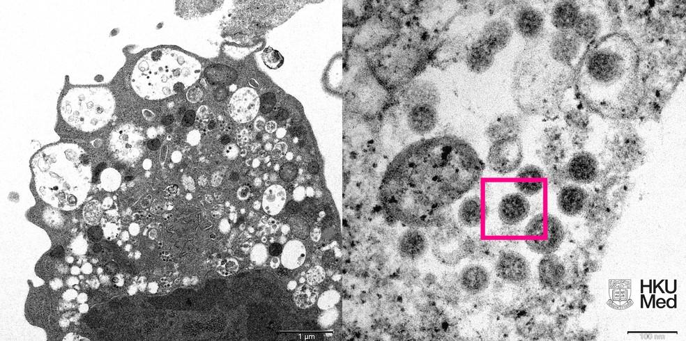 Subvariante da ômicron BA.2 é mais infecciosa do que 'original', diz estudo dinamarquês