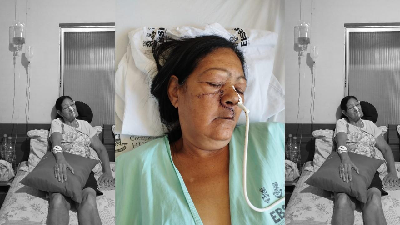 Família busca ajuda para tratamento de câncer de Dona Aracy, em Itanhém